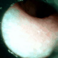 video1